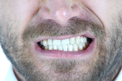 teeth of male with beard