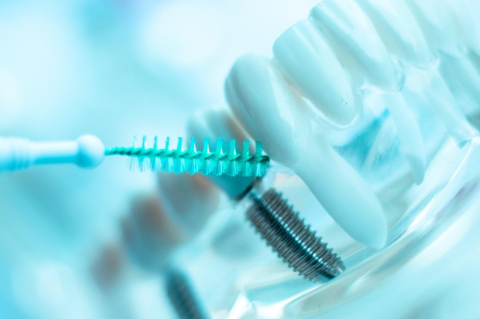 Close-up of an interdental brush being used to clean a model of a jaw with a visible implant.