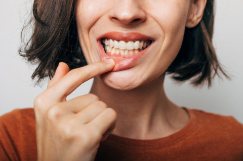 A woman pulls down her lower lip to show her gums